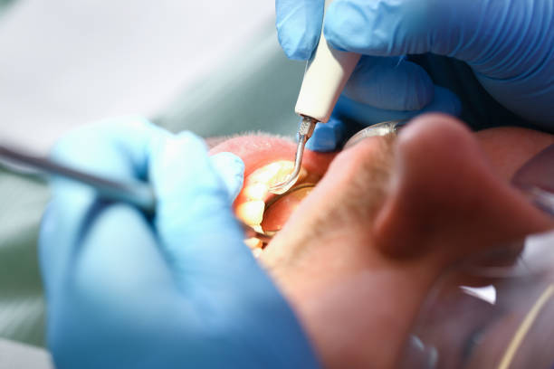 Best Emergency Dental Services for Seniors in Elm City, NC
