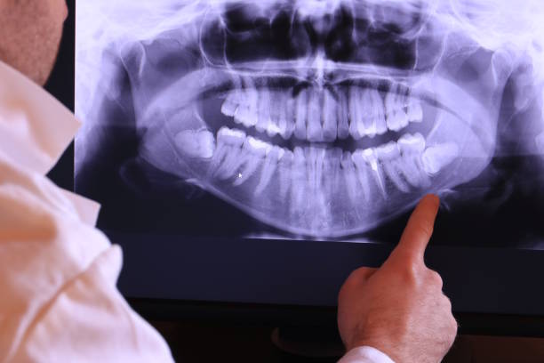 Best Pediatric Emergency Dentist in Elm City, NC