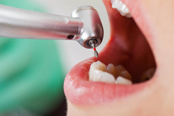 Best Orthodontic Emergency Dentist in Elm City, NC